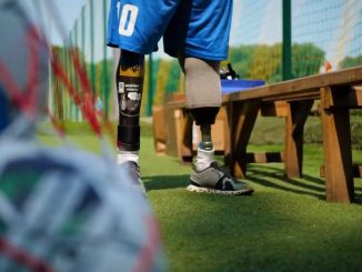 Ампутфутбол, команда з ампутфутболу, змагання з ампутфутболу, новини спорту, новини Кропивницького і Кіровоградщини